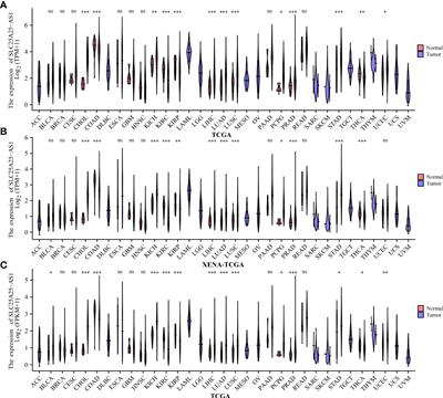 SLC25A25-AS1 over-expression could be predicted the dismal prognosis and was related to the immune microenvironment in prostate cancer